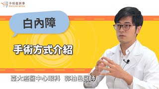 Cataract Surgery Options｜National Taiwan University Hospital