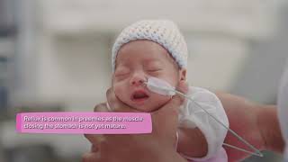 Premature baby - Nutrition and feeding