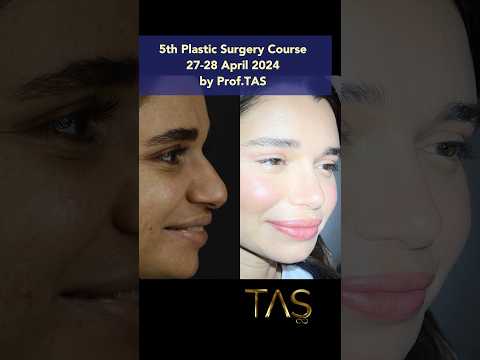 #rhinoplasty Thick skin is always a challenge in nosejob. How I did it?5th Plastic Surgery Course.