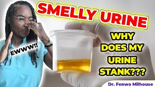 SMELLY URINE | CAUSES WHY YOUR URINE STANK | Dr. Milhouse