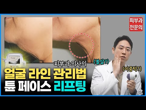 통증없는 "튠 페이스 리프팅" 제대로 관리 받는 방법 / 튠 페이스 리프팅의 모든 것