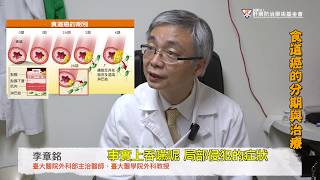 食道癌分期與治療 李章銘：中晚期仍有長期存活機會