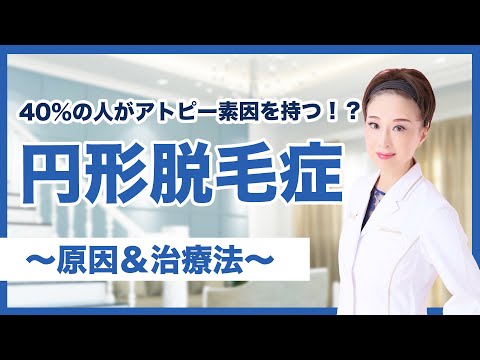 【皮膚科医が解説】アレルギー？ストレス？円形脱毛症の原因＆９つの治療法！！！！！