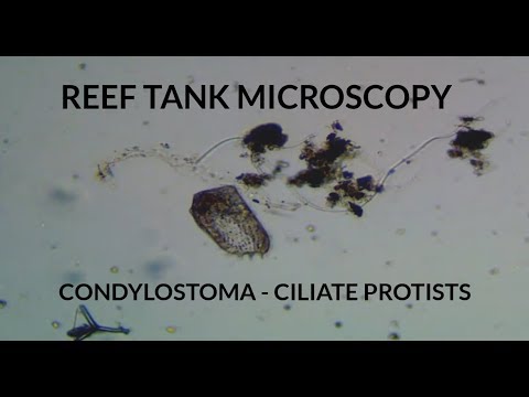 Reef Tank Microscopy - Ciliate Protists