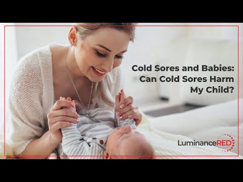 Cold Sores and Babies: Can Cold Sores Harm My Child?