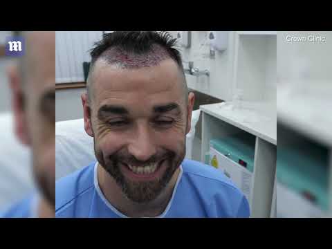 Ben Jardine undergoes hair transplant to find 'the perfect woman'