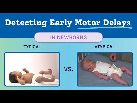 Newborn Typical & Atypical Development | Baby Motor Development Exam