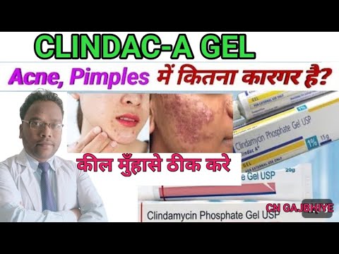 How to use Clindac-A gel, how to apply Clindac-A gel,uses,side effects,benefits #cngajbhiye