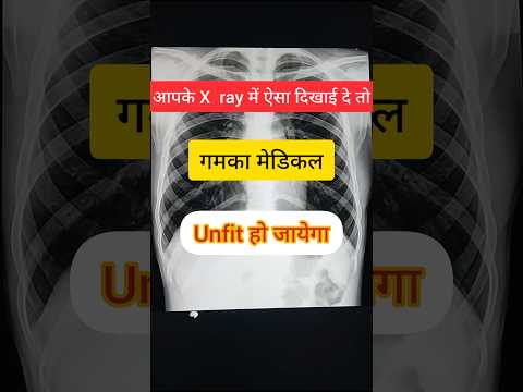 गमका मेडिकल में फेल हो सकते है l #neetmotivation #anatomy #medicalimaging