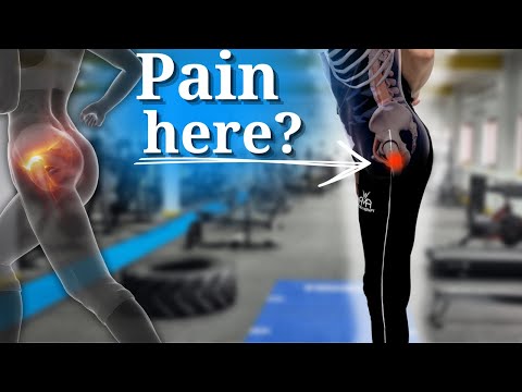 5 BEST Rehab Exercises For GTPS (Greater Trochanteric Pain Syndrome)!