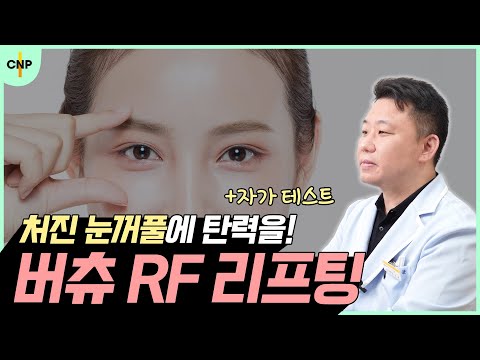 여의도리프팅 또렷한 눈매 완성을 위한 버츄 RF 눈꺼풀 리프팅!!