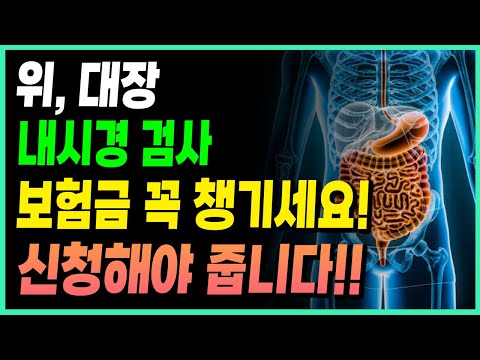 위내시경, 대장내시경 검사 보험금 받는 방법!! 이런방법이?! 꼭 받으세요!!