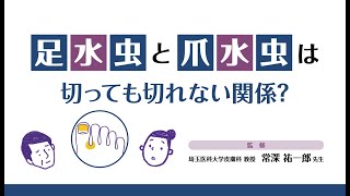 足水虫と爪水虫は切っても切れない関係？【科研製薬】