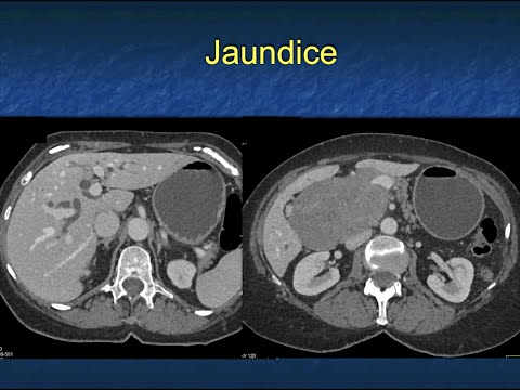 You Make the Call! Freestyle Radiology Quiz #13