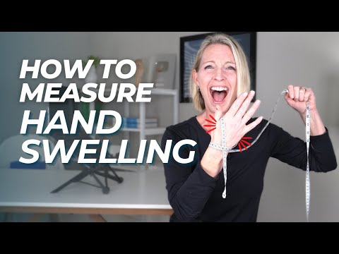 How to Measure Hand Swelling By Yourself: Figure of Eight Method