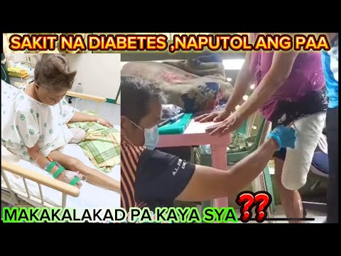 MATAPOS MAPUTOL ANG PAA MAKAKALAKAD PA KAYA SYA?#diabetes