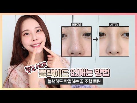 광고X!! 블랙헤드 없애는 방법👃🏻 블랙헤드 박멸하는 꿀 조합 루틴 [ENG/JPN/SPA SUB]