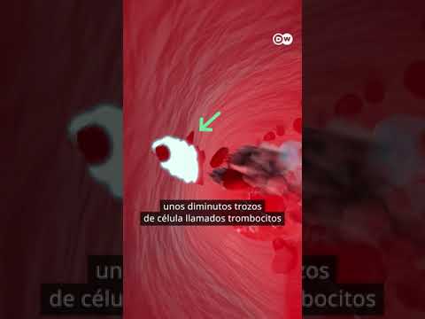 ¿Cómo cura tu cuerpo las heridas?