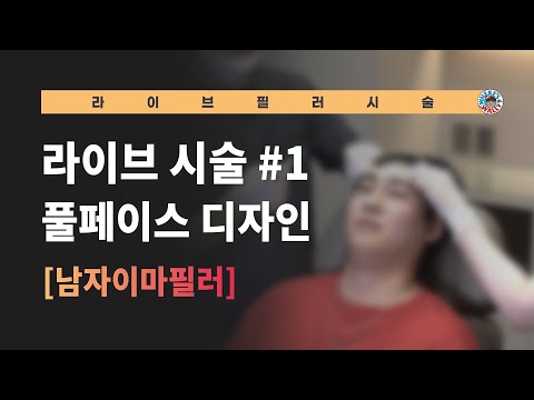 (ENG sub) 이마필러 시술 라이브 ! (Filler injection Live demonstration)