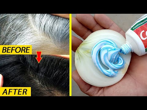 From White Hair To Black Hair Naturally and Permanently in Just 30 Minutes and Grow Hair With Egg