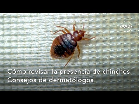 Cómo detectar chinches: Consejos del dermatólogo