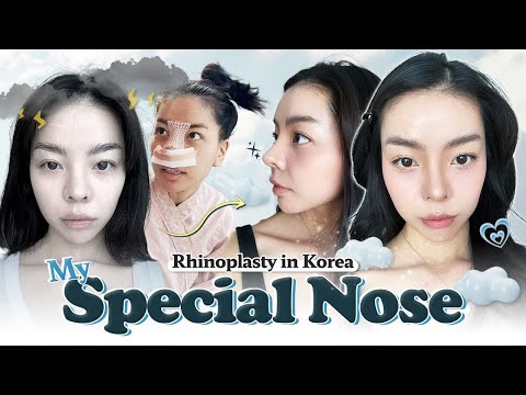 I got a new nose in Korea and I LOVE it! | Nana's rhinoplasty at Braun PART 1 💖