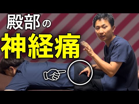 【実技】殿部の痺れは双子筋と内閉鎖筋に介入！