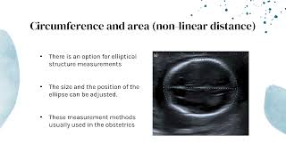 B-Mode Measurements in Ultrasound Imaging - Mohammed Alhibshi