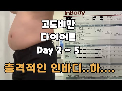 요요 고도비만 다이어트 브이로그 기록 2~5일차 충격적인 인바디 결과