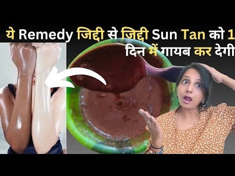 Remove Sun-Tan Instantly : ये Remedy जिद्दी से जिद्दी Sun Tan को 15 मिनट में गायब कर देगी💕