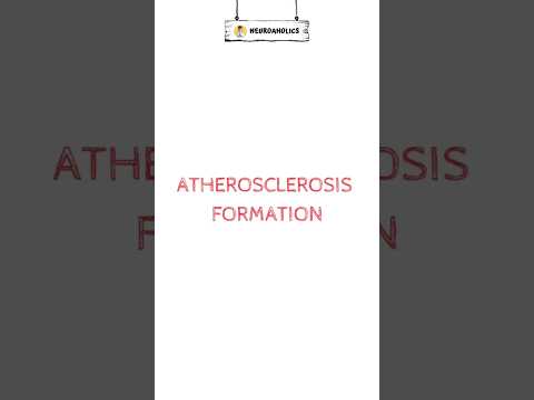 Atherosclerosis formation🔥 #atherosclerosis #stroke #shorts