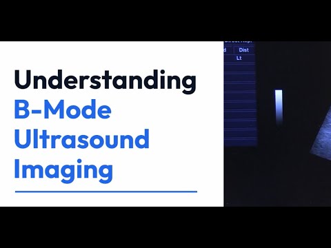 B Mode Ultrasound | Modes of Ultrasound | Ultrasonography | Abdominal | Obs | Gyne