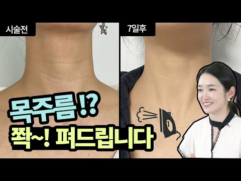 목주름 진짜 없애는 시술 3 l 피부탄력 l 피부좋아지는법