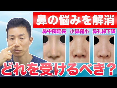 【鼻整形】鼻中隔延長と小鼻縮小と鼻孔縁下降を徹底比較｜自分はどれを受けるべき？