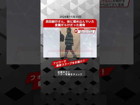 西田敏行さん、体に埋め込んでいた金属だらけだった遺骨 NEWSポストセブン【ショート動画】