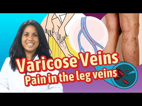 What are Varicose Veins and Venous Insufficiency?