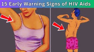 15 Warning Signs of HIV | AIDS Symptoms in Men | HIV Symptoms in MEN | HIV Symptoms in Women