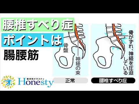 【腰椎すべり症の治し方】ポイントは腸腰筋！寝ながらほぐして腰椎の負担を減らします。