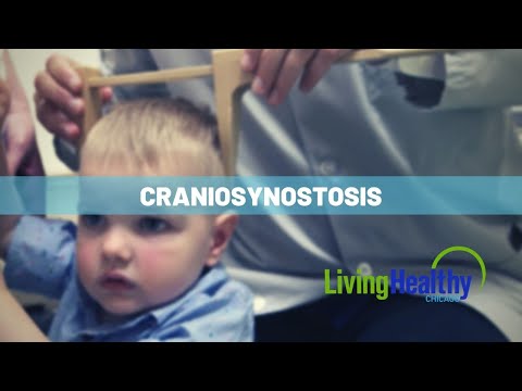 Navigating A Diagnosis of Craniosynostosis