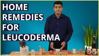 3 Best LEUCODERMA (VITILIGO) Treatments At Home With Natural Remedies