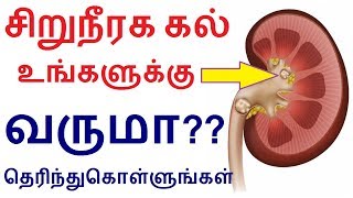 சிறுநீரக கல் உங்களுக்கு வருமா தெரிந்துகொள்ளுங்கள் | Kidney stone in Tamil