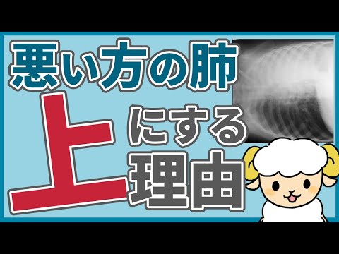 【知らないと損】悪い方の肺を上にする理由【正解：SpO2が上がる】