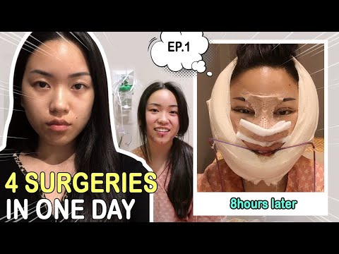 MY PLASTIC SURGERY IN KOREA PART1│FACIAL CONTOURING, RHINOPLASTY, DOUBLE EYELID SURGERY CONSULTATION