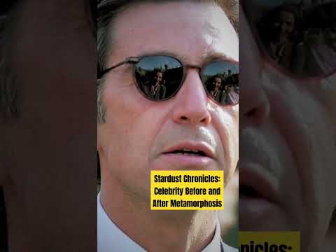 Stardust Chronicles: Celebrity Before and After Metamorphosis#viral#youtube#shortsvideo#celebrity