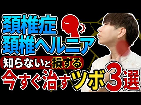 【一撃で効く】頚椎症・頚椎ヘルニアを今すぐ治すツボTOP３