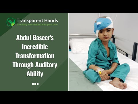 Abdul Baseer Gained the Hearing Ability Through Cochlear Implant