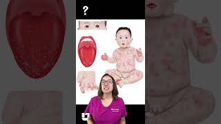 Decreased albumin with Kawasaki disease - Ask Nurse Cathy: Pediatrics SHORT | @LevelUpRN