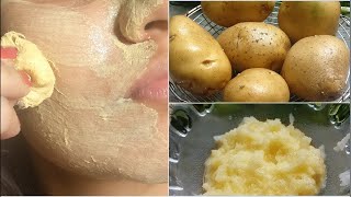 3 दिन: Potato Face Pack - चेहरे की झाइयां, दाग- धब्बे व् कालापन हटाए ! Skin Whitening Remedy