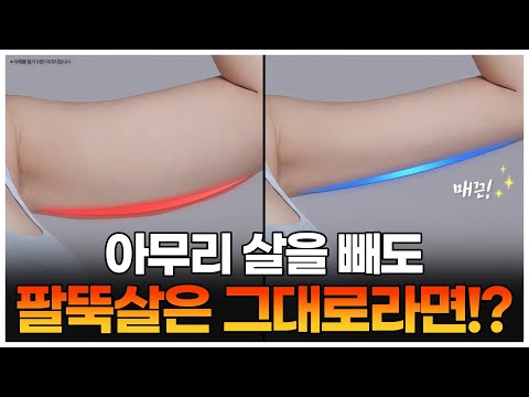 울쎄라 VS 더블로! 바디 트루스컬프와 함께 내 팔뚝살을 날려버릴 원장님의 시술 PICK!