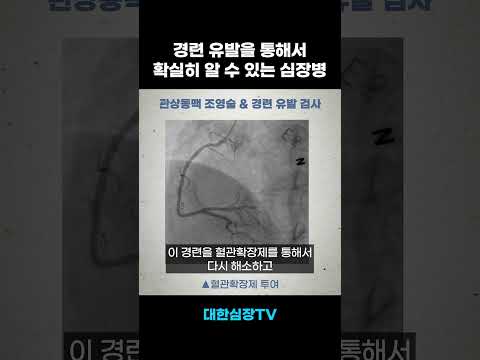 신기한 변이형 협심증 진단 방법 #shorts